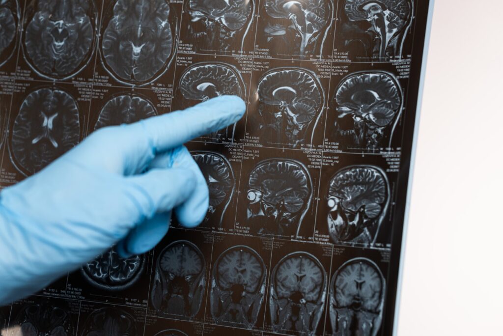A clinician reviewing brain imaging